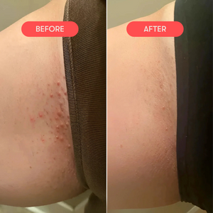 Ingrown Magic Wand